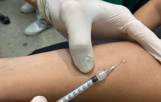 Infecção latente orienta tratamento preventivo contra tuberculose em Manaus