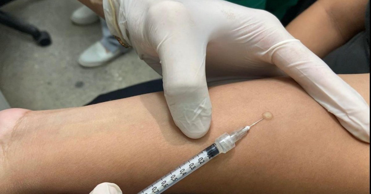 Infecção latente orienta tratamento preventivo contra tuberculose em Manaus